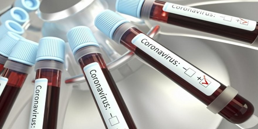'Koronavirüs vakasının tespit edildiği il bilgisi paylaşılmalı'