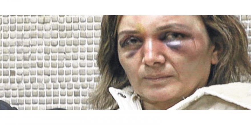 Eski eşi tarafından katledilen Ayşe Paşalı için Türkiye'den itiraf: Koruyamadık