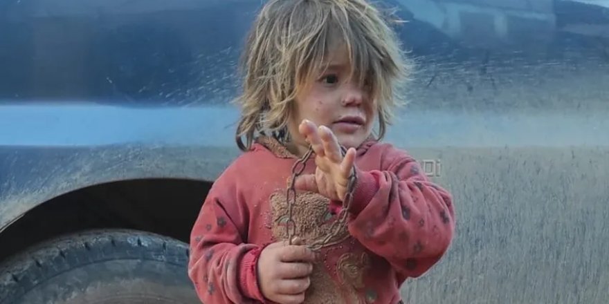 İdlib'de babasının zincirlediği 6 yaşındaki çocuk açlıktan öldü