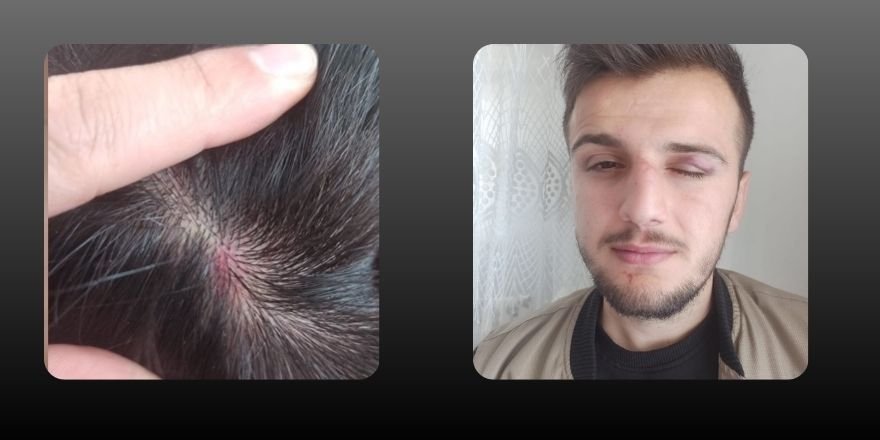 Polis, 'Zafer işaretinin yasak olduğu' gerekçesiyle gençleri darp etti