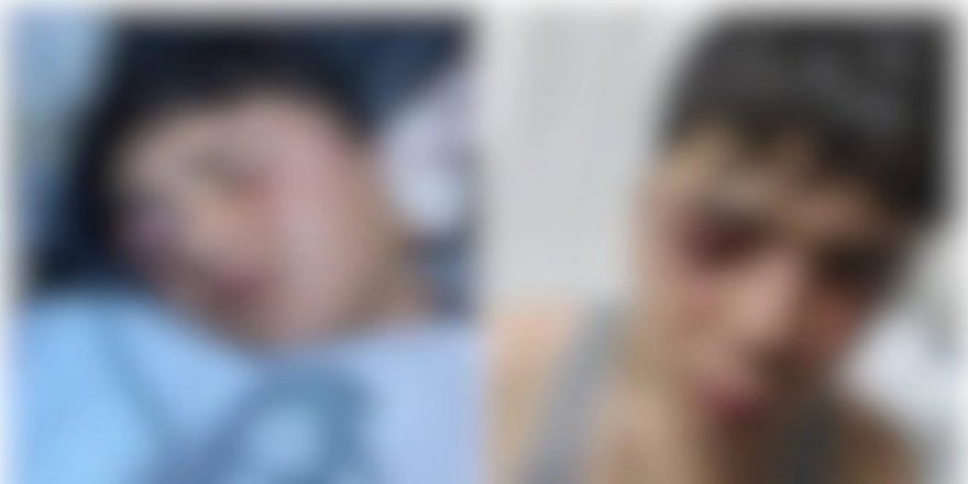 Lice’de şiddet gören çocuğun babasına ‘Beyaz Toros’ tehdidi