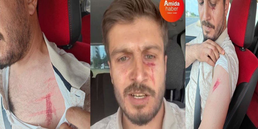 Diyarbakır... 20 aylık bebeğinin yanında, polis tarafından darp edildi!