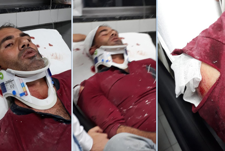 Ankara’da Kürt işçilere saldırı... Birini 5. kattan aşağı attılar