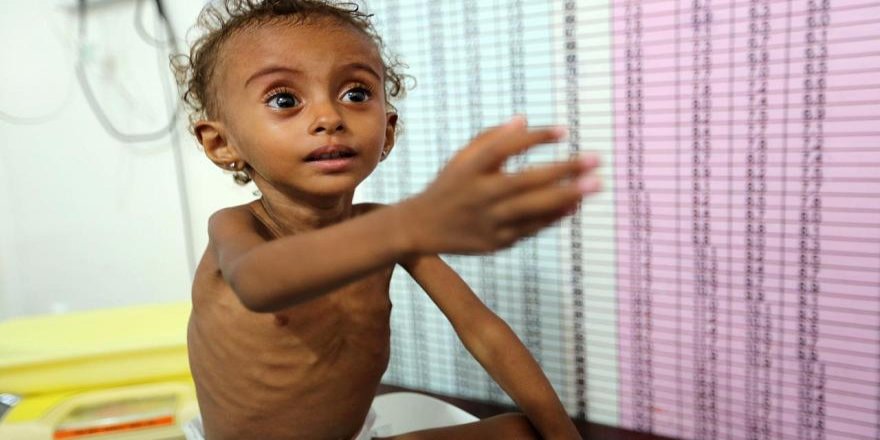 Save the Children: Yemen'de 2019'da 100 bin çocuk koleraya yakalandı
