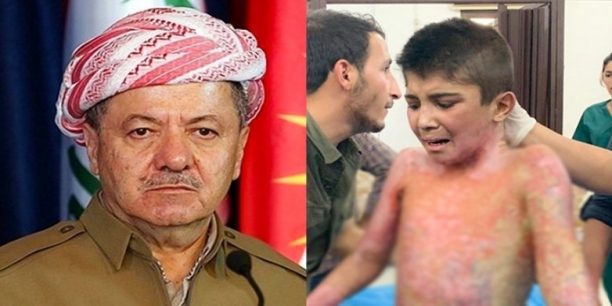 Başkan Barzani Serê Kaniyê'de yaralanan çocuğu aradı