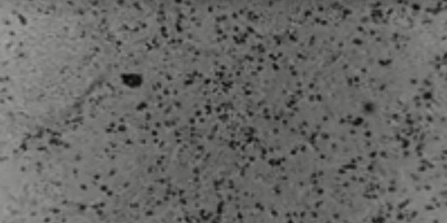 Virüsü kopyasıyla vuracaklar: Genomu çıkarıldı