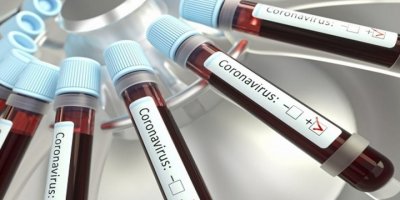 'Koronavirüs vakasının tespit edildiği il bilgisi paylaşılmalı'