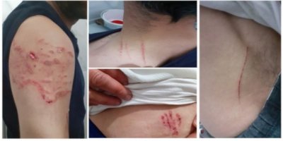 Diyarbakır'da evi basılan aileye köpekle işkence