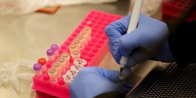 Coronavirüsü etkisiz hale getiren protein bulundu