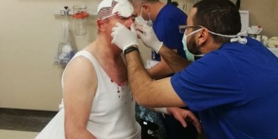 Gelecek Partisi Genel Başkan Yardımcısı Özdağ’a silahlı saldırı