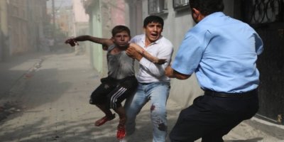 Cizre'deki patlamada uzuv kaybı yaşayan 13 yaşındaki Yusuf'a tazminat