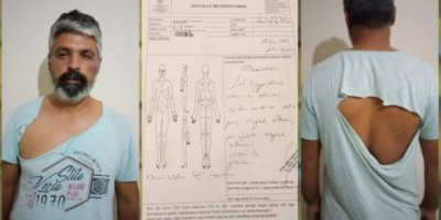 Antalya'da yol kontrolü yapan ırkçı grup bir kişiyi darp etti