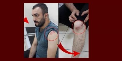 AYM'den 'pantolon paçası' bahanesiyle polislerin darp ettiği terziyle ilgili karar