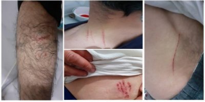 Köpekli işkencede bakanlık tazminata mahkum edildi