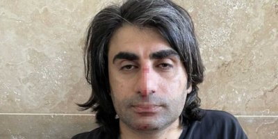 Batman'da Polis şiddetini durdurmak isteyen avukat da darp edildi