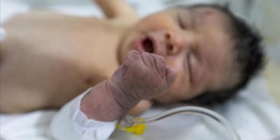 Suriye: Enkaz altında ölmüş annesine göbek bağıyla bağlı olarak bulundu, kurtarıldı