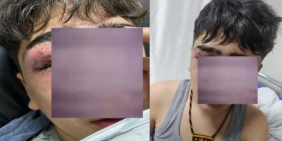 ‘İstiklal Marşı’ söylemeye zorlanan 10 yaşındaki çocuk hastanelik edildi!