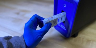 Maymun çiçeği virüsünün 'daha bulaşıcı' varyantı İsveç'te görüldü