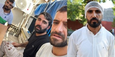 Balıkesir'de ırkçı saldırıya uğrayan işçi anlattı: Organize bir saldırıydı