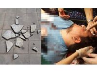 URFA/ Şiddete uğrayan doktor ameliyata alındı