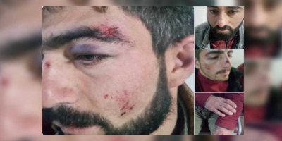 Sayımı bekliyorlardı..Darp edildiler, gözaltına alındılar!