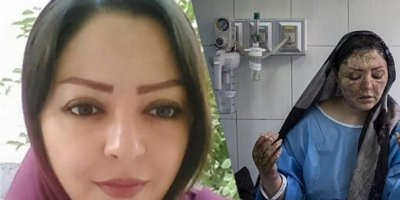 Artan kezzaplı saldırılara karşı yeni yasa