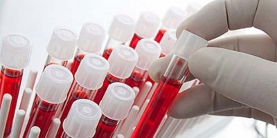 Kansere en dirençli kan grubu '0'