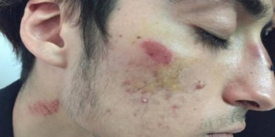 Antalya’da ırkçı saldırıya uğrayan Kürt öğrenciler okulu bıraktı