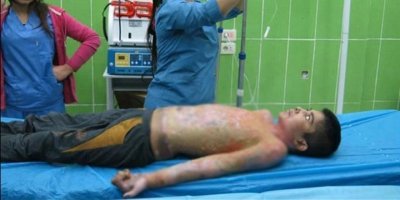 ABD Kongre üyeleri: Türkiye'nin beyaz fosfor kullanıp kullanmadığı araştırılsın